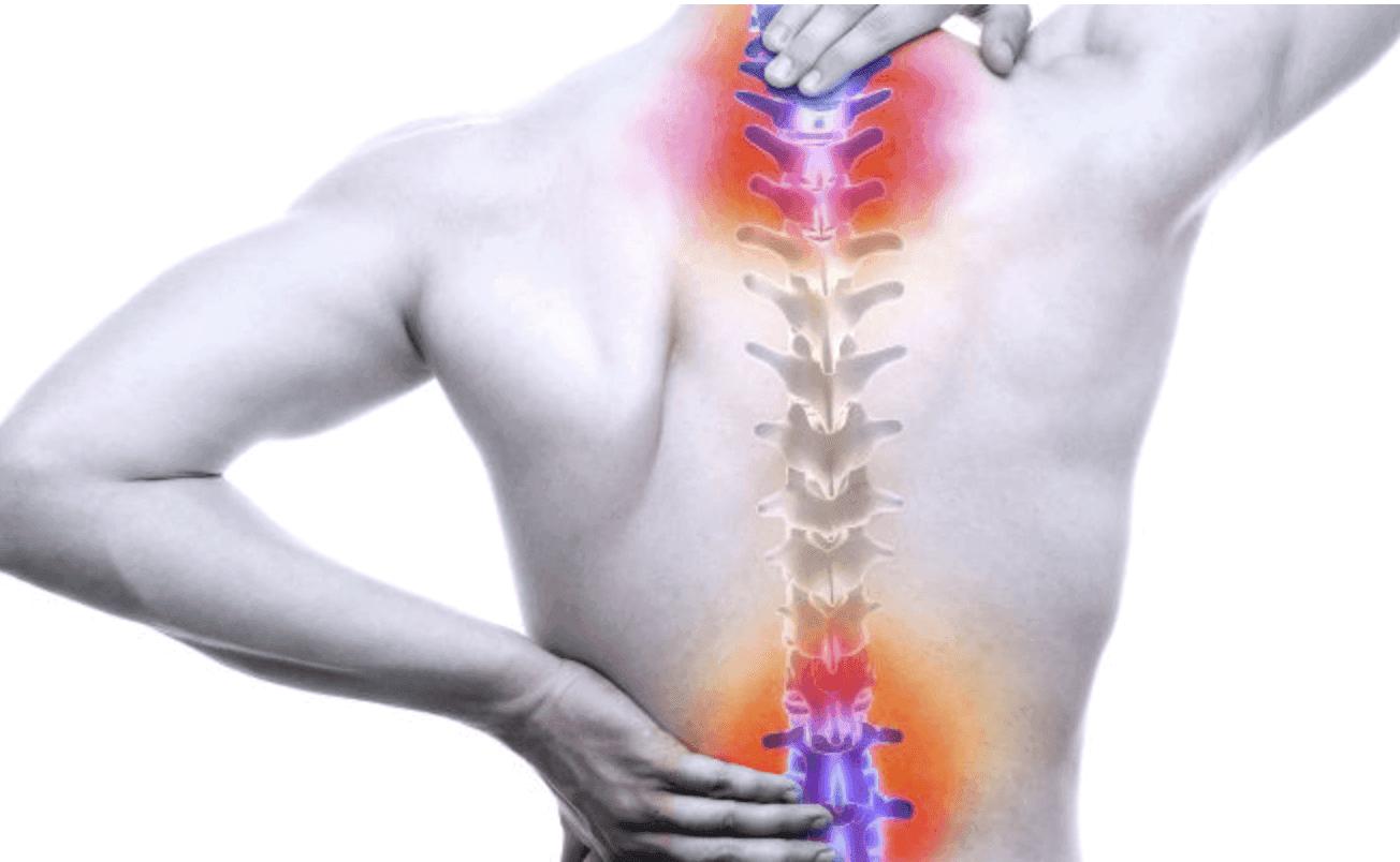 Cover image for the article: Understanding Back Pain